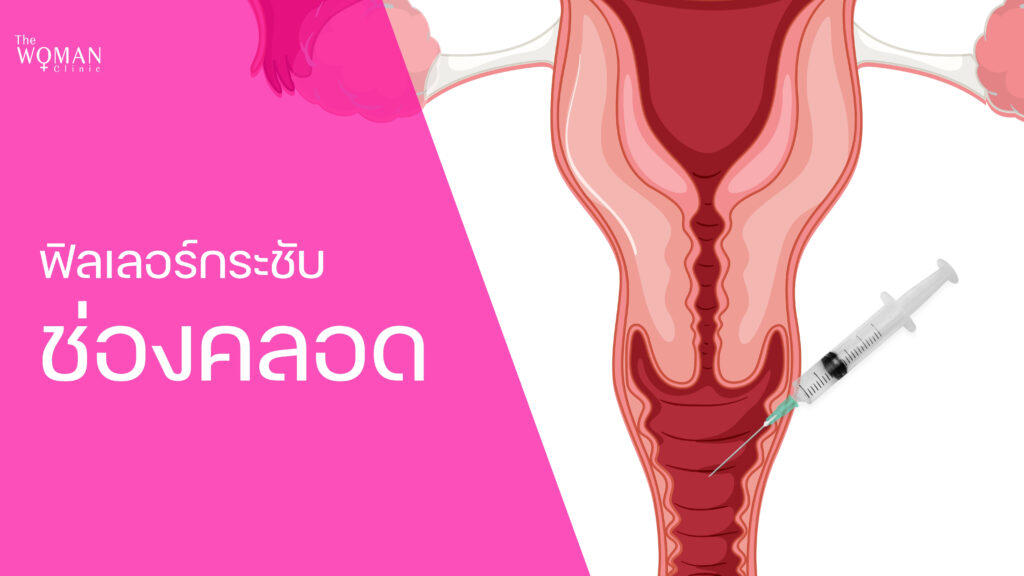 ฟิลเลอร์ฉีดกระชับช่องคลอด