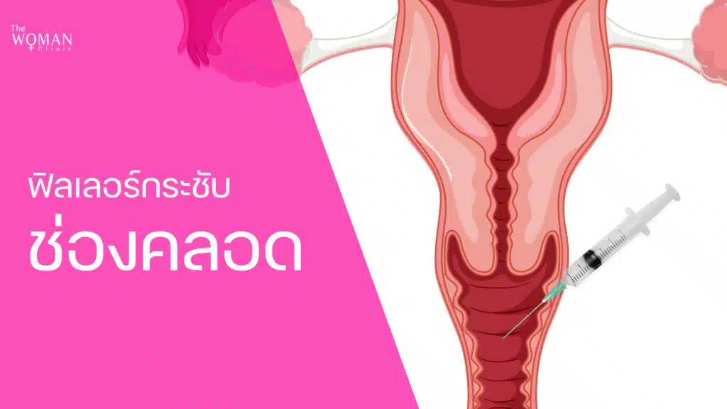 ฟิลเลอร์ฉีดกระชับช่องคลอด
